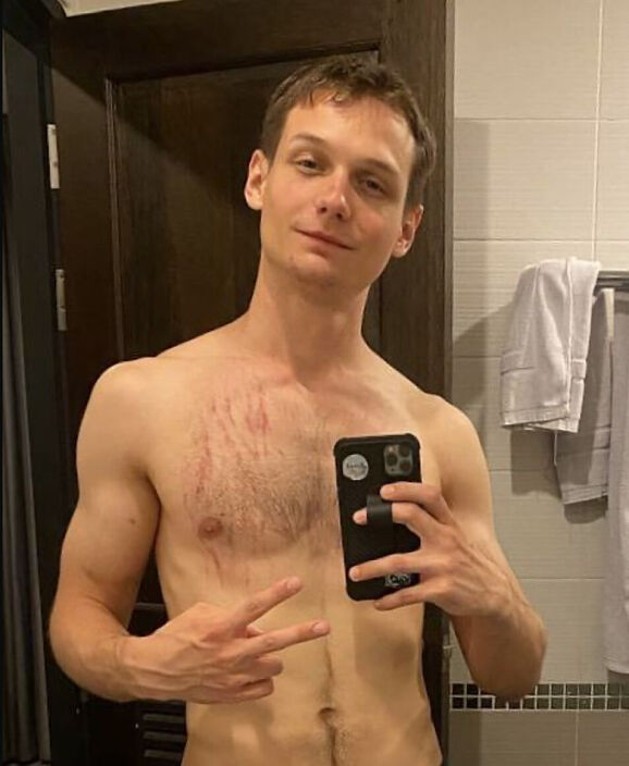 Боевые шрамы :)