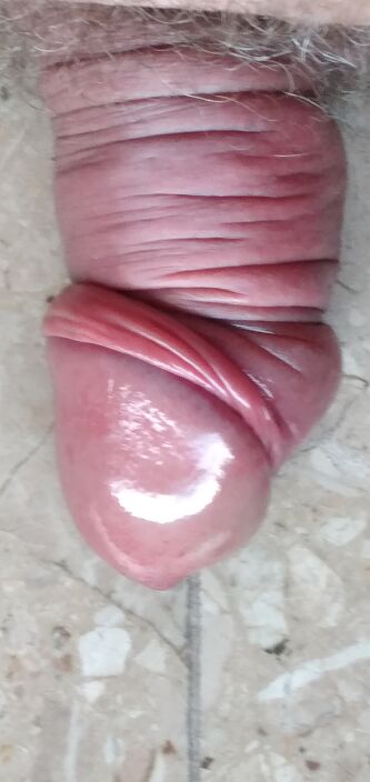 После пумпе