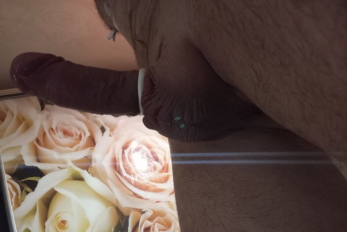 Kvc nnvc