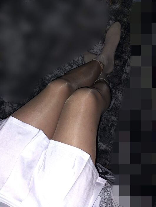 Снимаю опухоль на лобке на дому