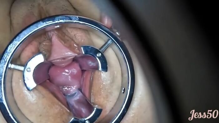 Растяжка для влагалища