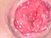 #####