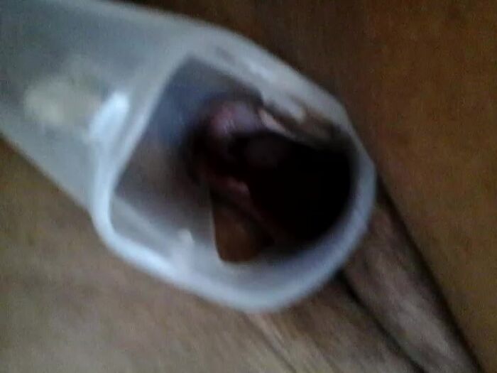 Пациентка        вагину посмотрела