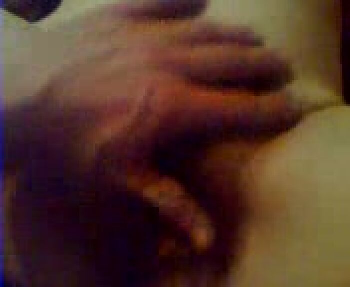 Волосаточка на моём члене