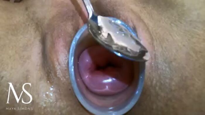 Расширение матки