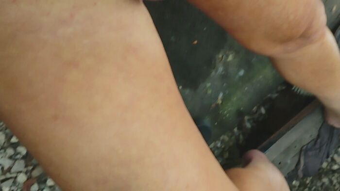 Measuring my 1mm peepee