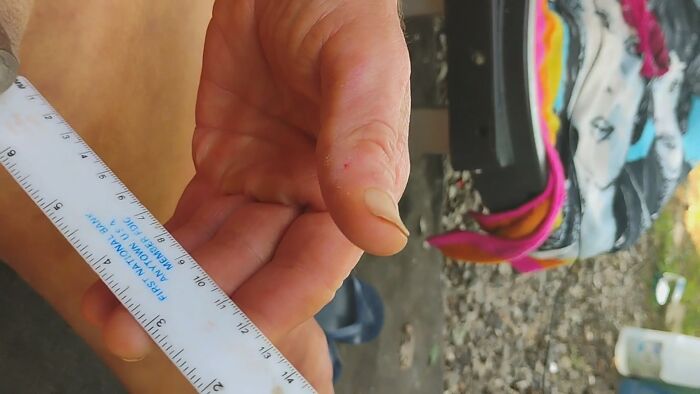 Measuring my 1mm peepee