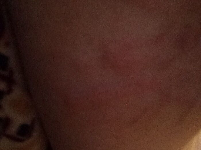 После порки