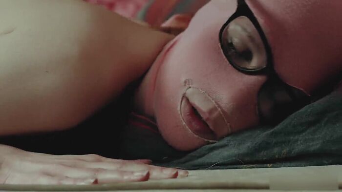 Мохнатка жжёт