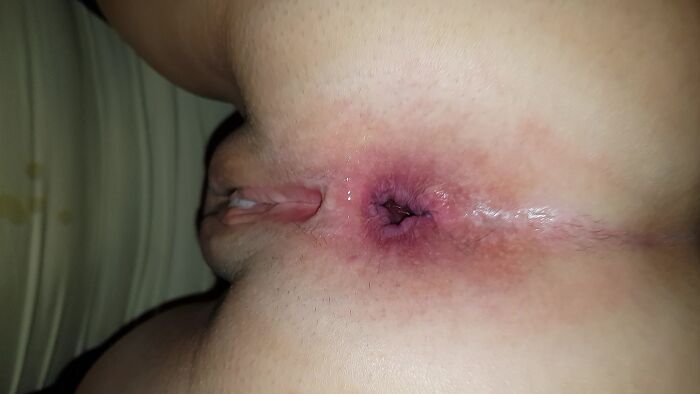 После анала