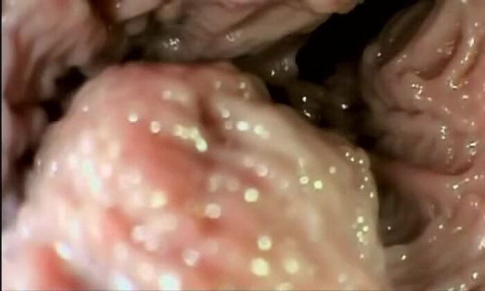 Личные видео