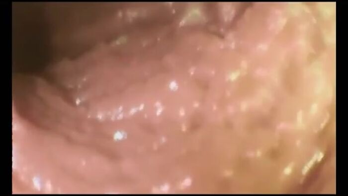 Камера во влагалище