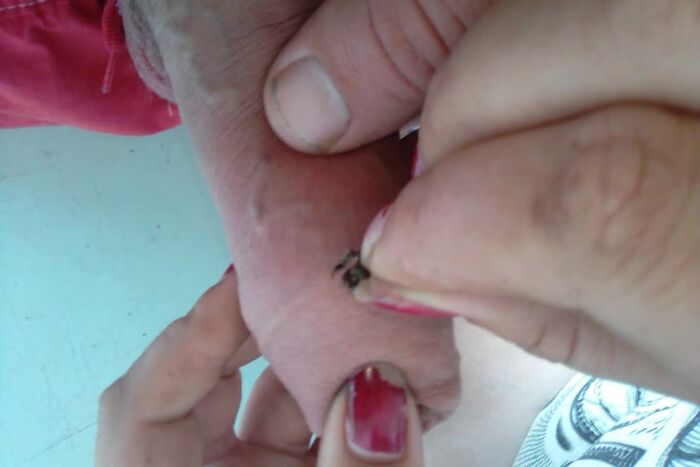 Жена жалит бджолой