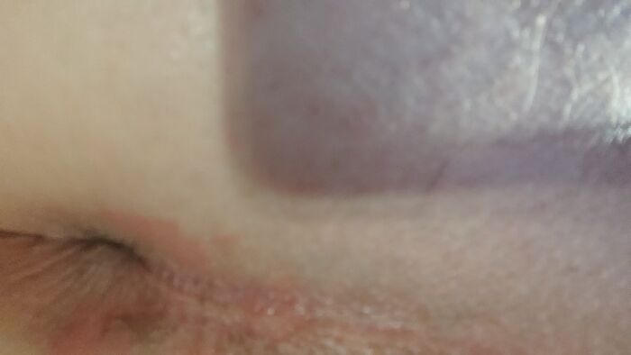 Пульсирует после маленького члена