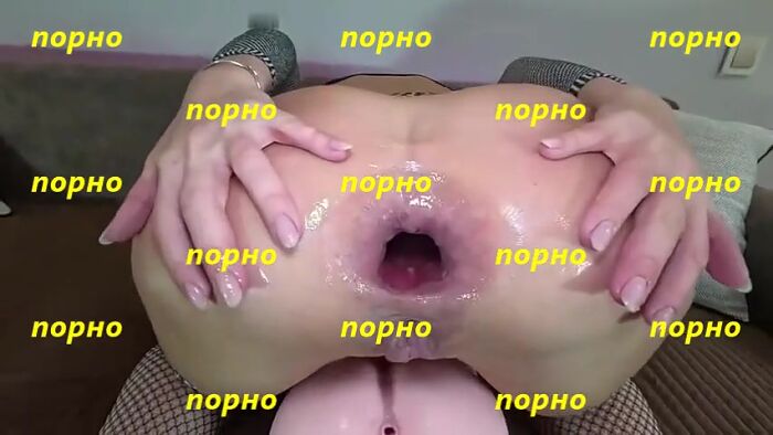 Фистинг