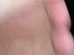.......
