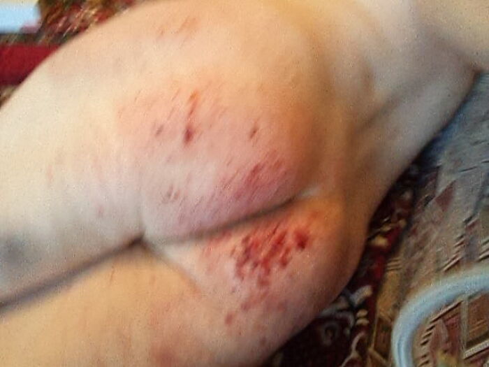 Следы жёсткой порки