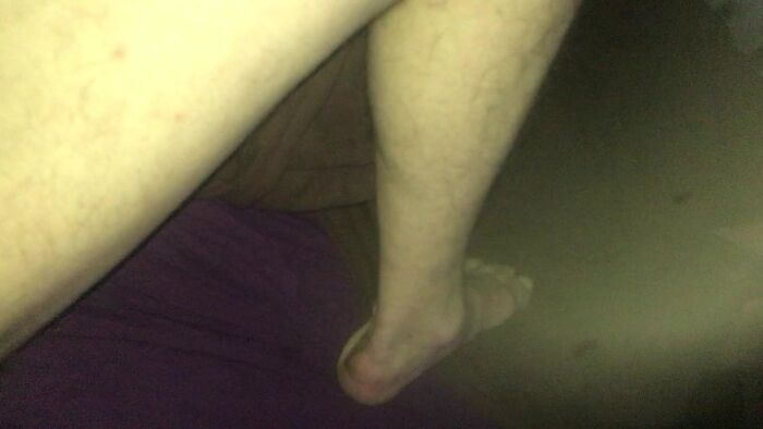 Распухли яички , член преврашается в маленький писюнь