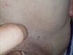 Anal