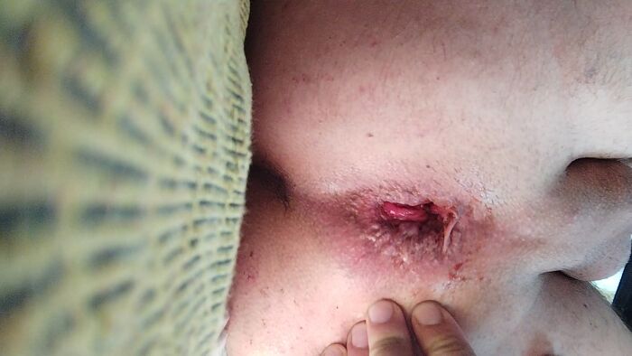 Моя дырка)))/