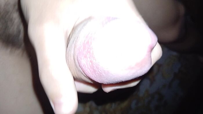 Дрочу с открытой головкой.)